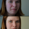 before_n_after