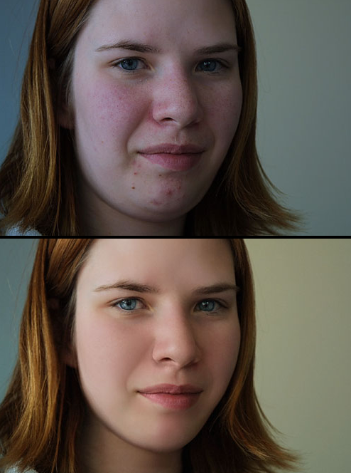 before_n_after